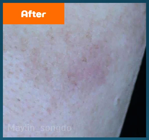 before_image