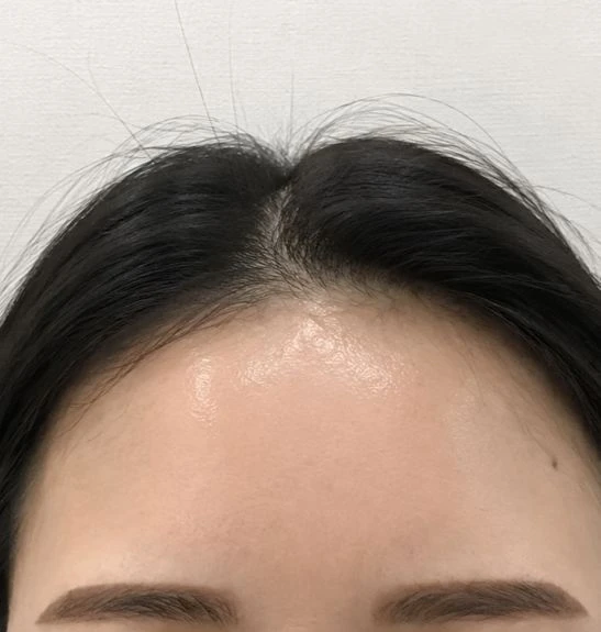 before_image
