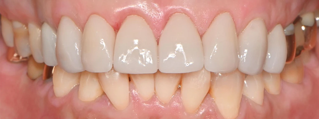 before_image