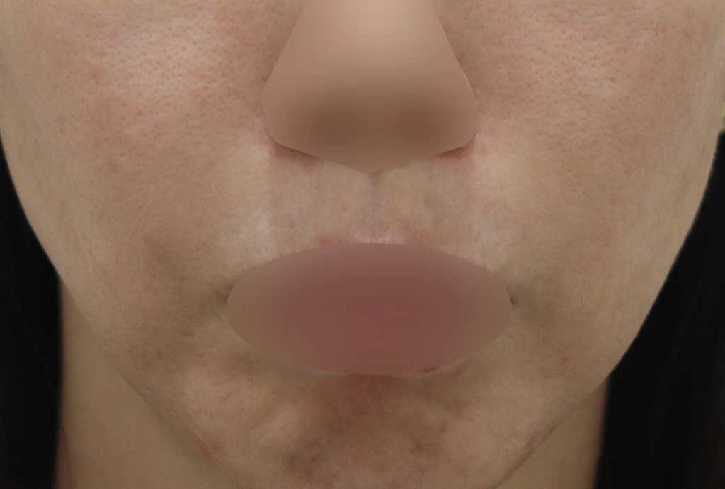 before_image