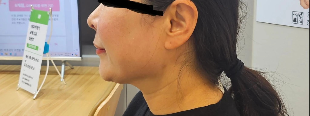 before_image