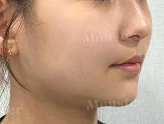 before_image