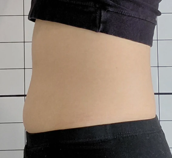 before_image