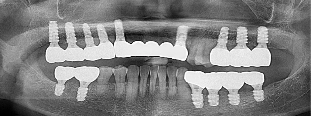 before_image