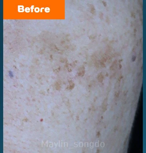 before_image