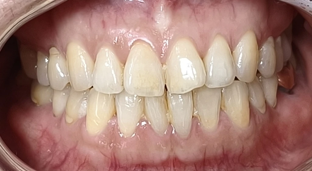 before_image