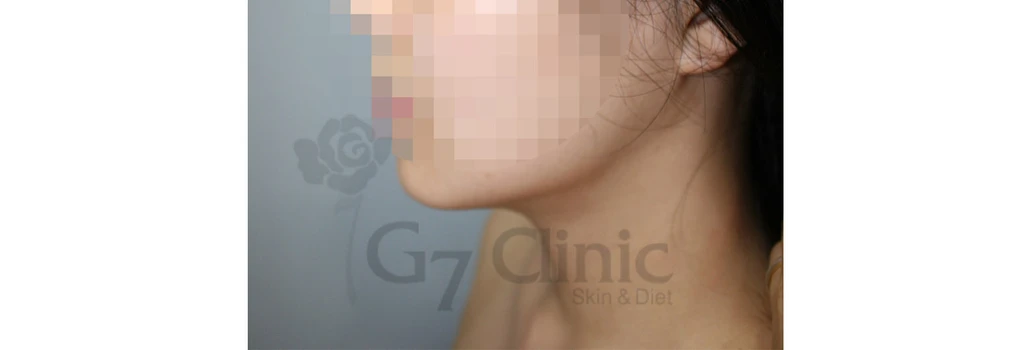 before_image