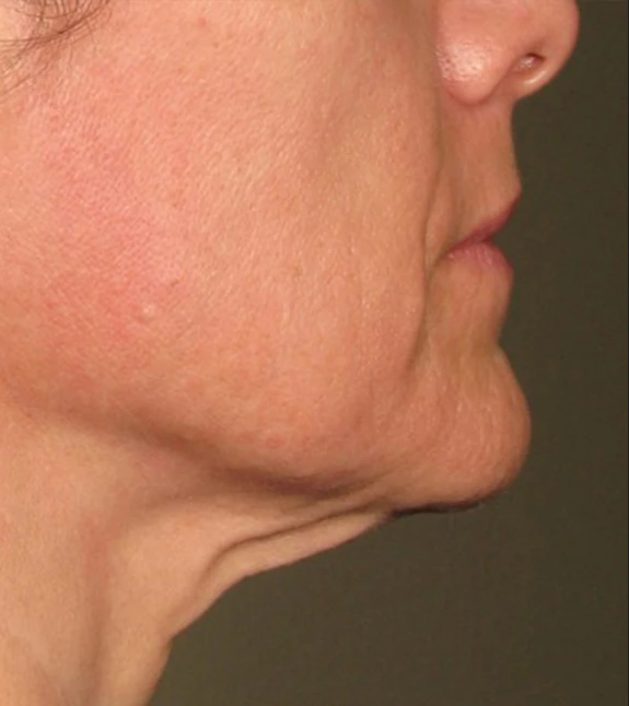 before_image