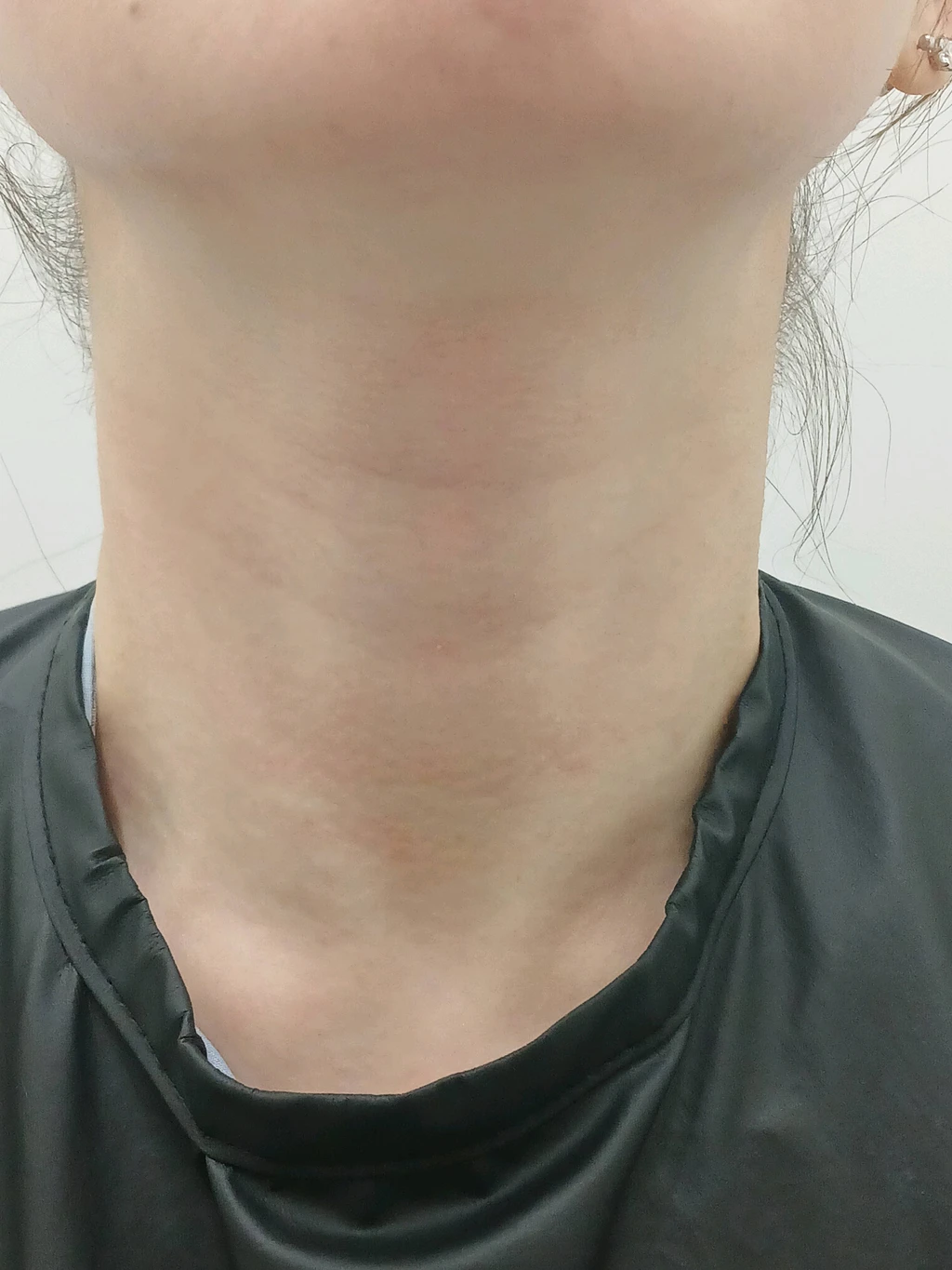 before_image
