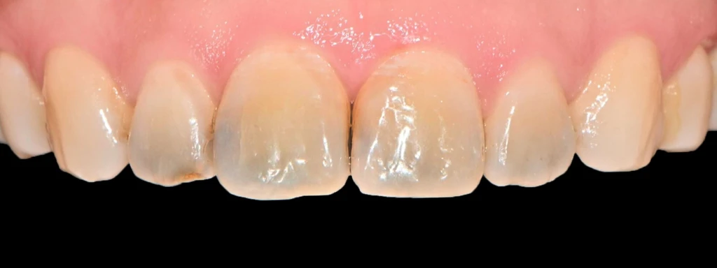 before_image