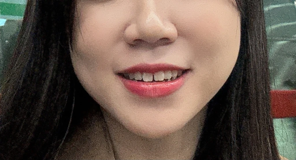 before_image