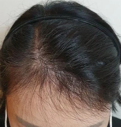 before_image
