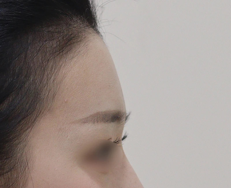 before_image