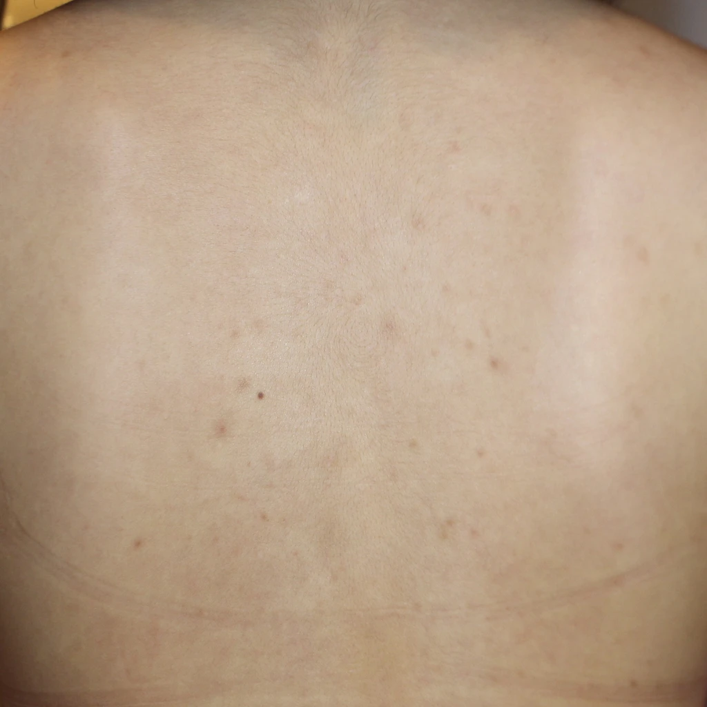 before_image