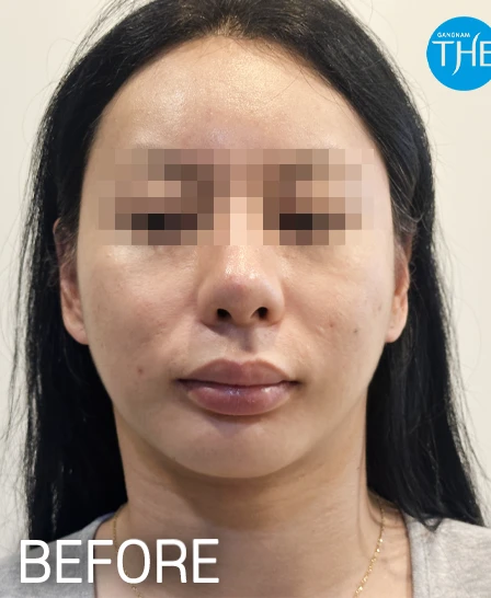 before_image