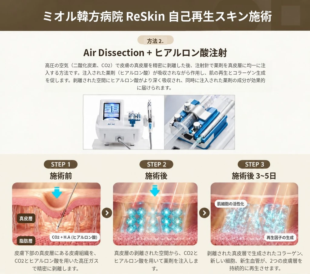treatmentIntroduction
