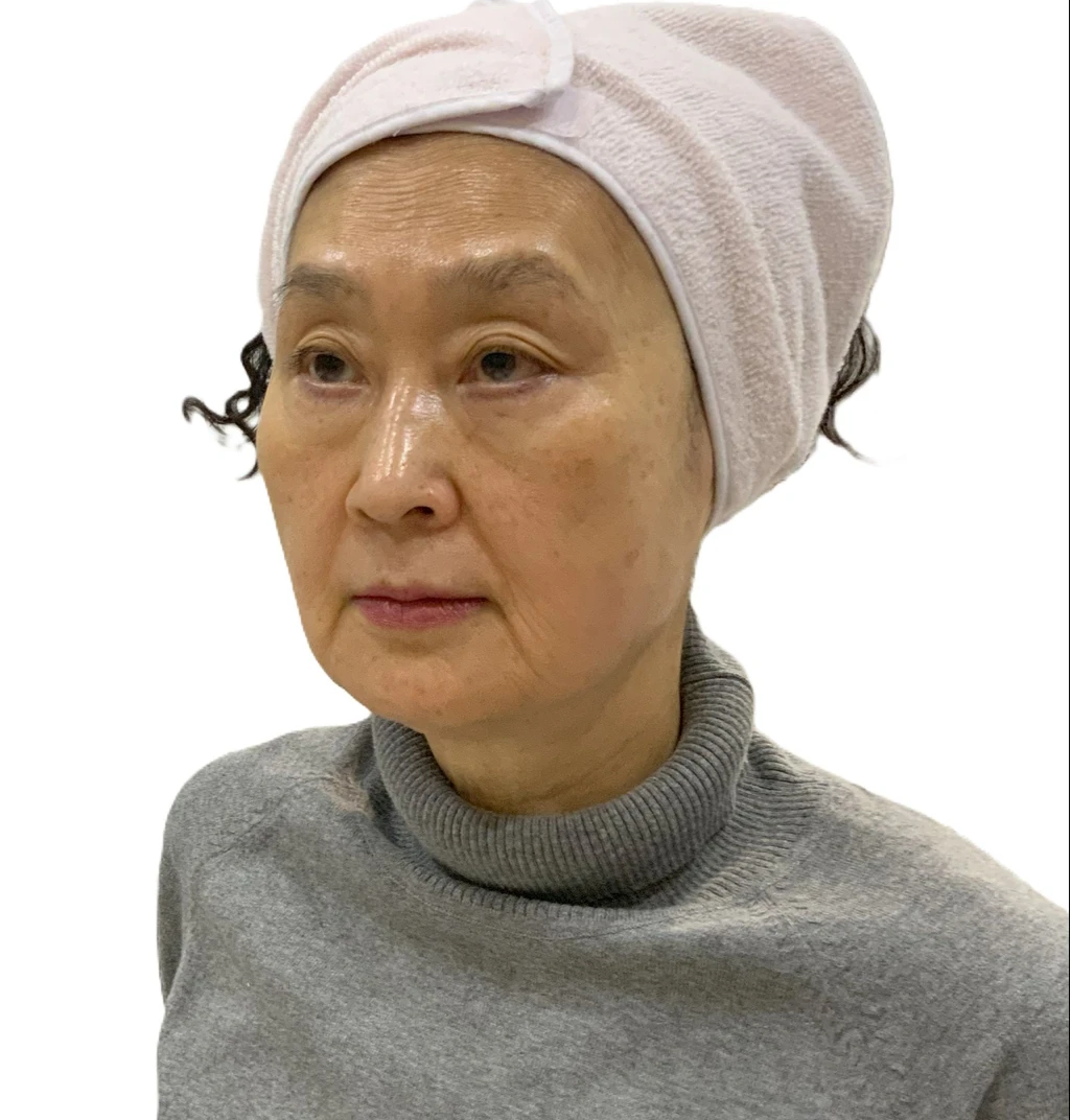 before_image