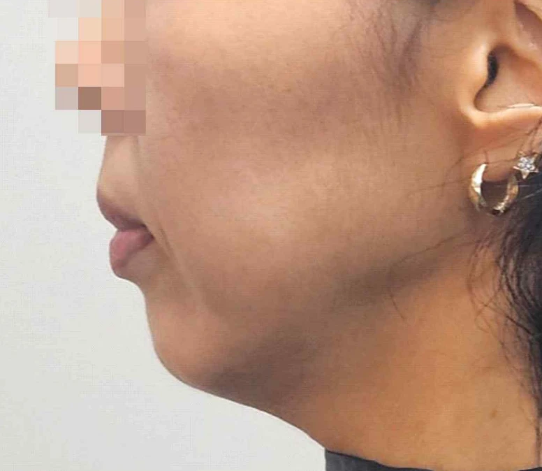 before_image