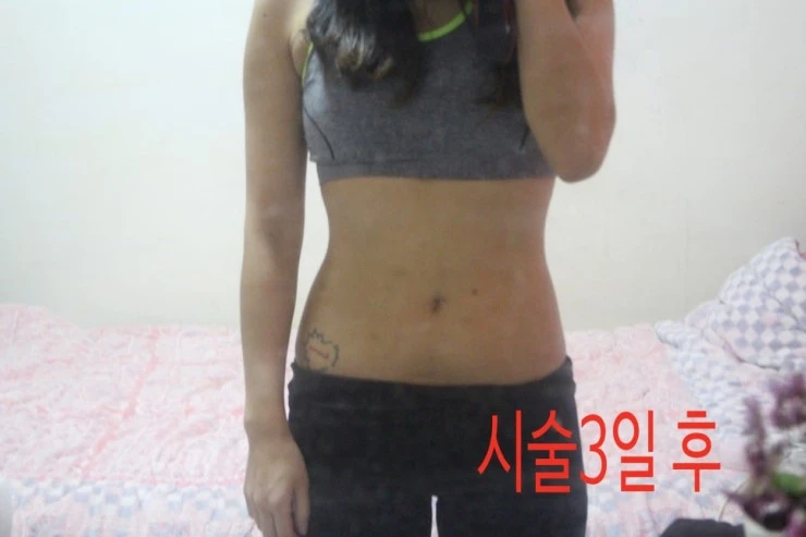 before_image