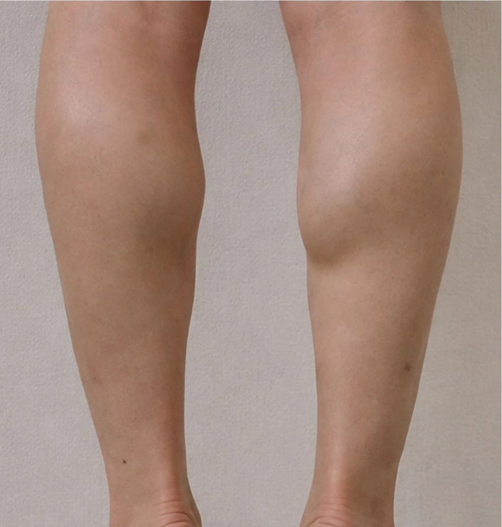 before_image