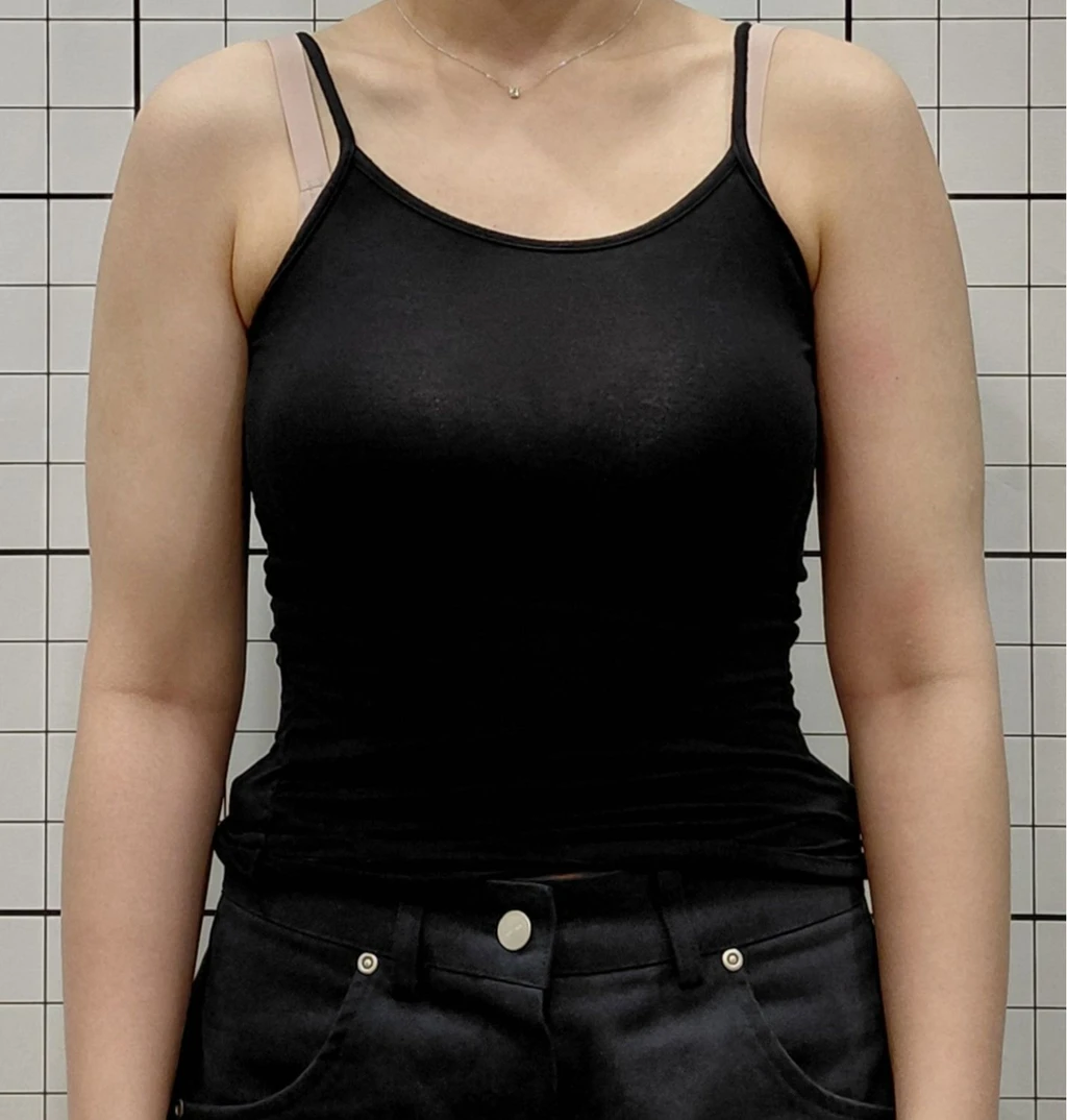 before_image