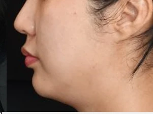 before_image