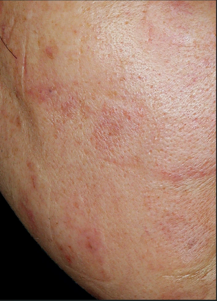 before_image
