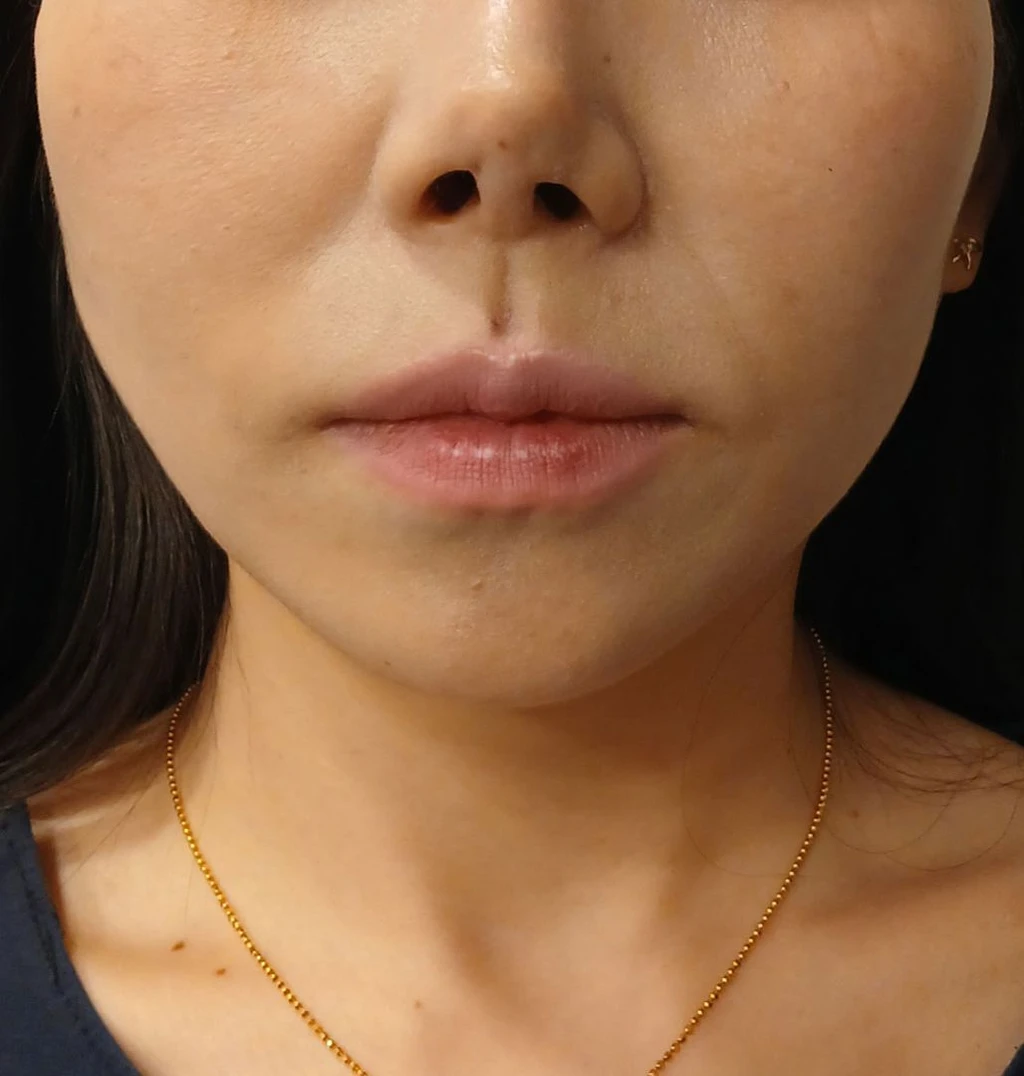 before_image