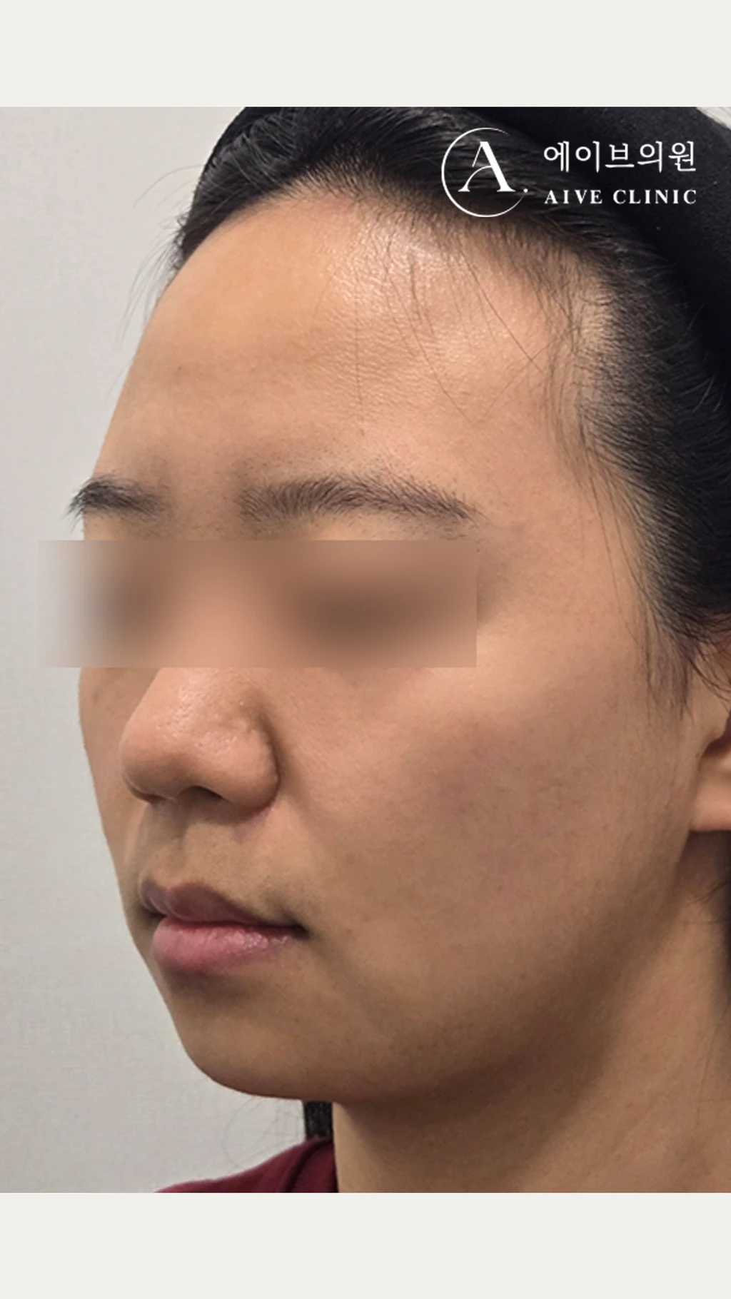 before_image