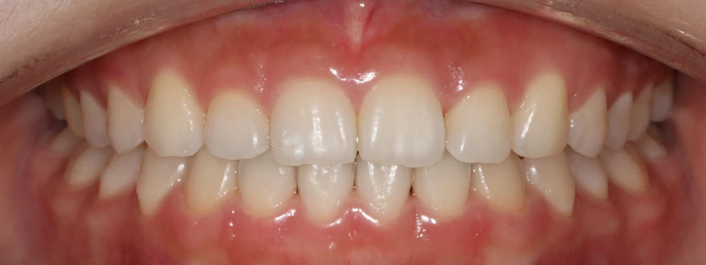 before_image