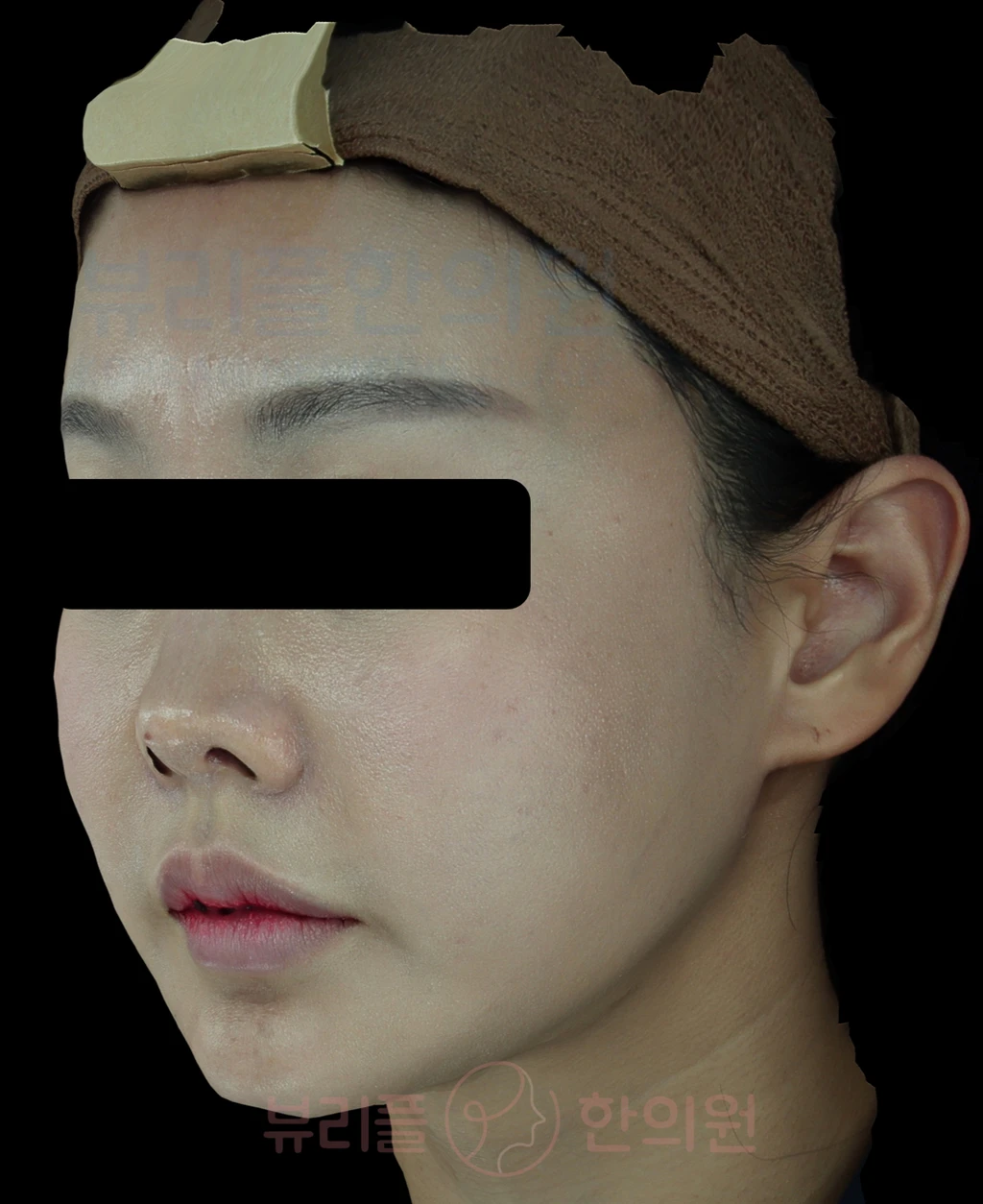 before_image