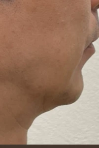 before_image