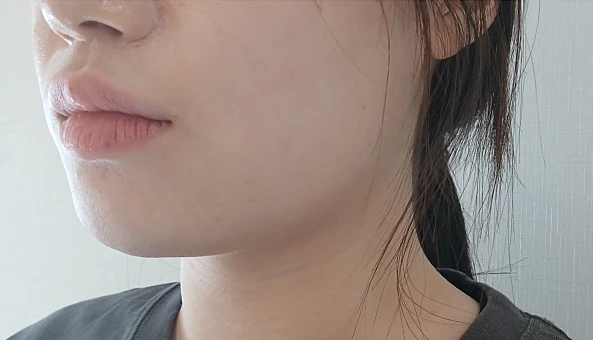 before_image