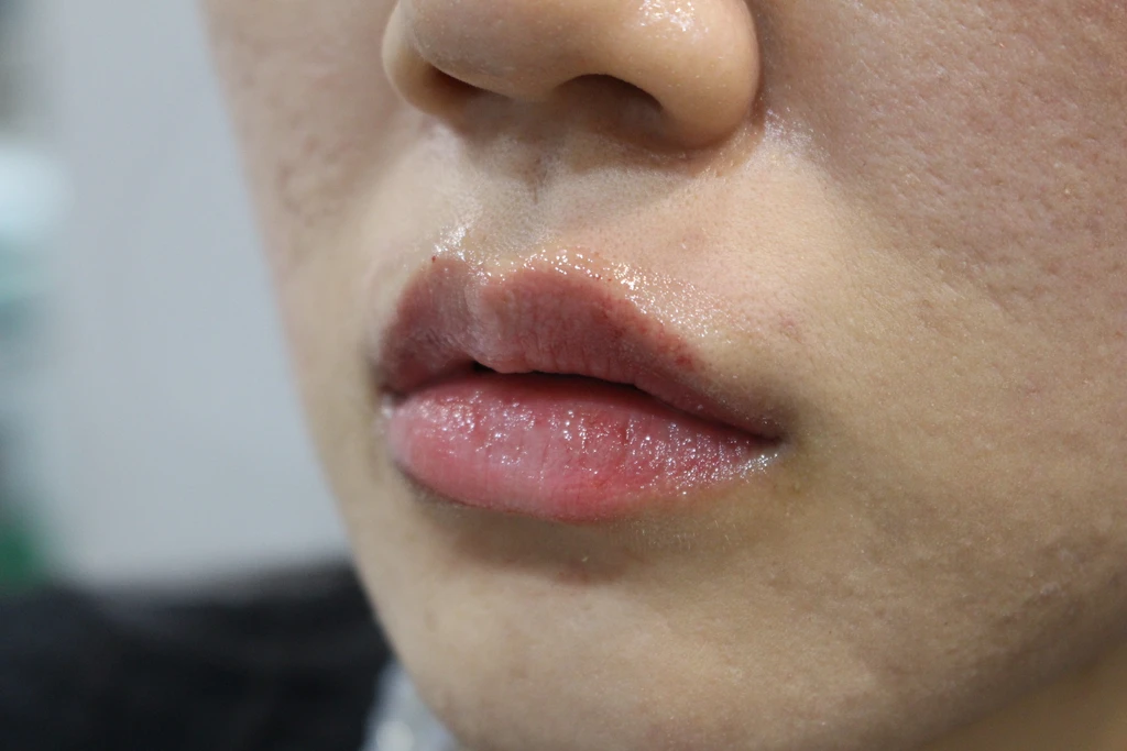 before_image