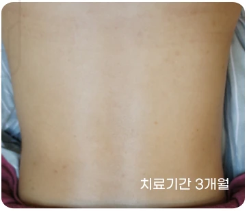 before_image