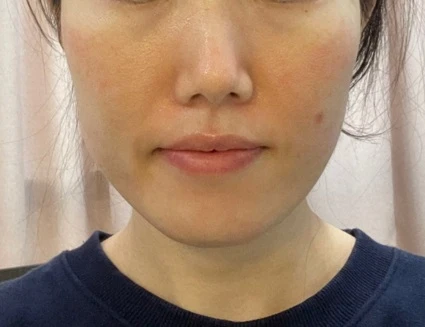 before_image