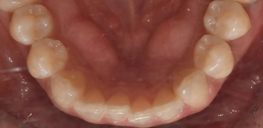 before_image