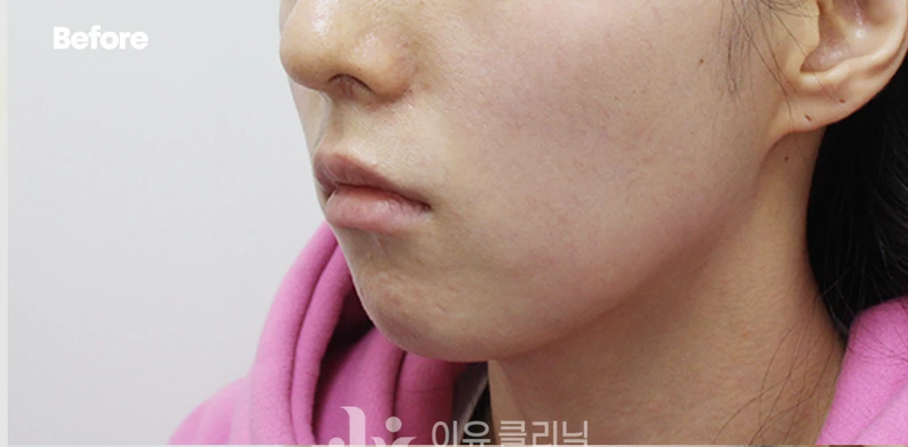 before_image