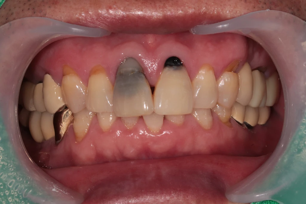 before_image