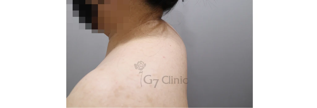 before_image