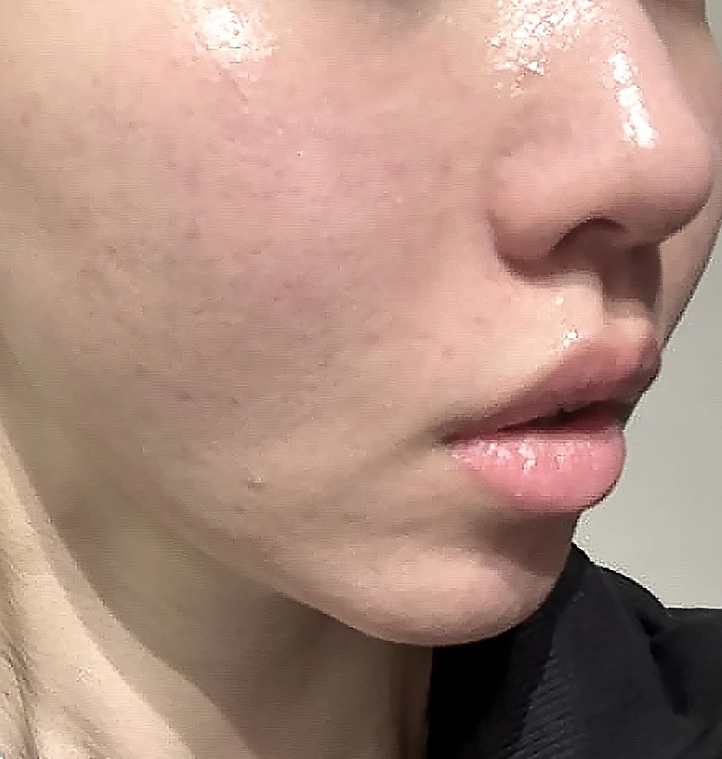 before_image