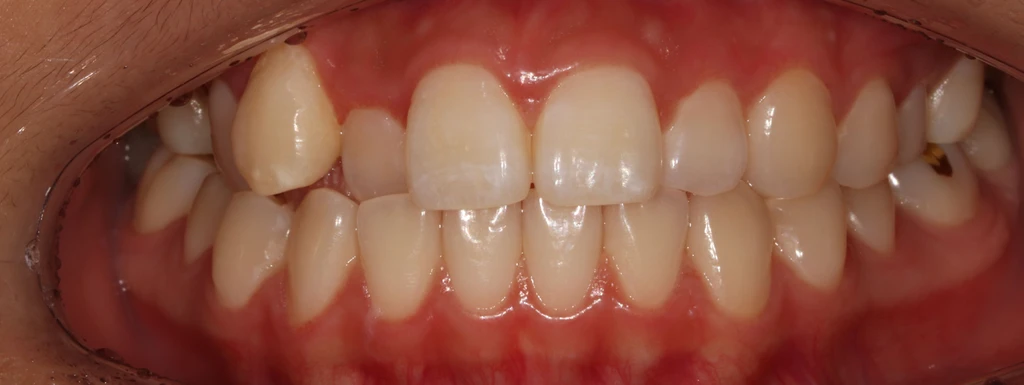 before_image