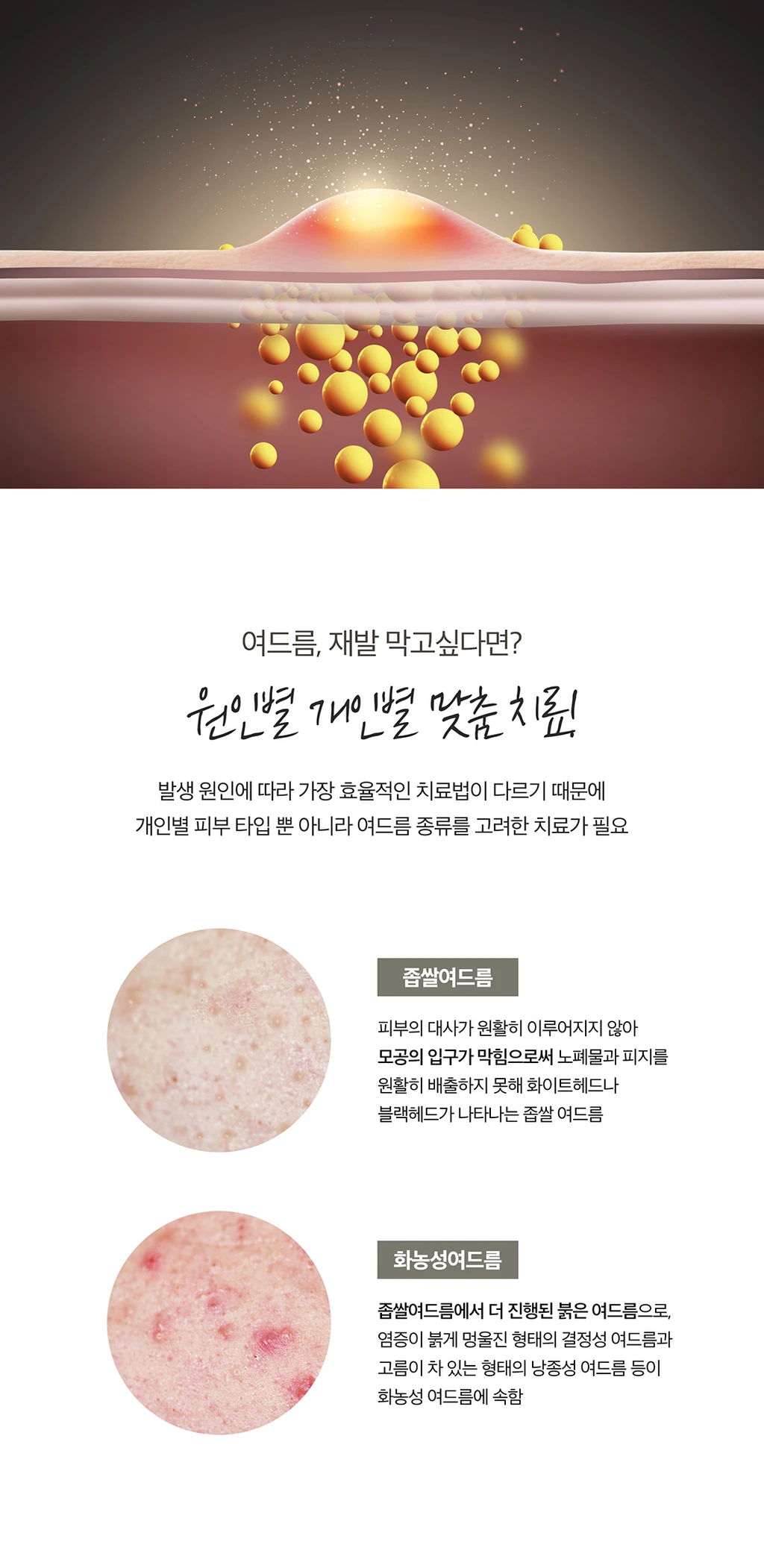 treatmentIntroduction