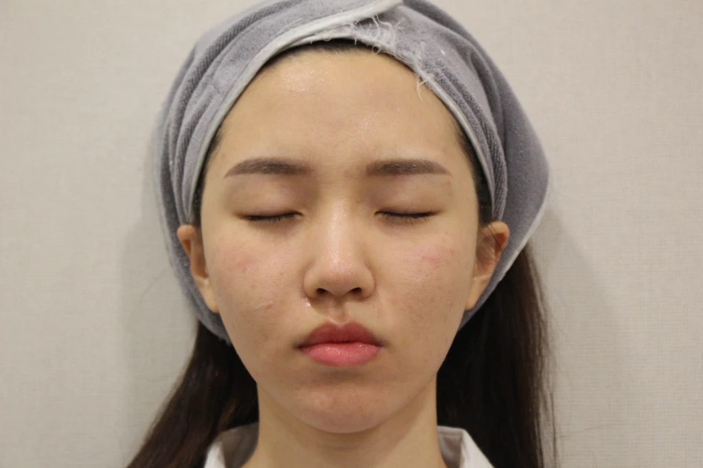 before_image
