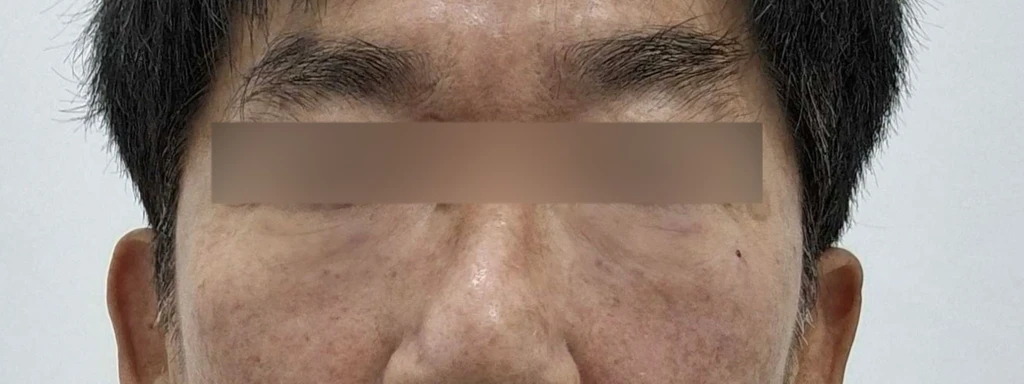 before_image