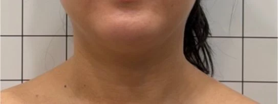 before_image