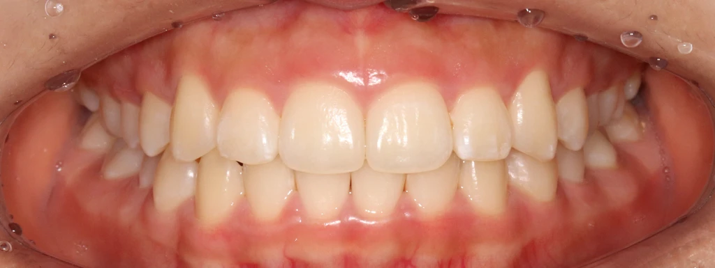 before_image