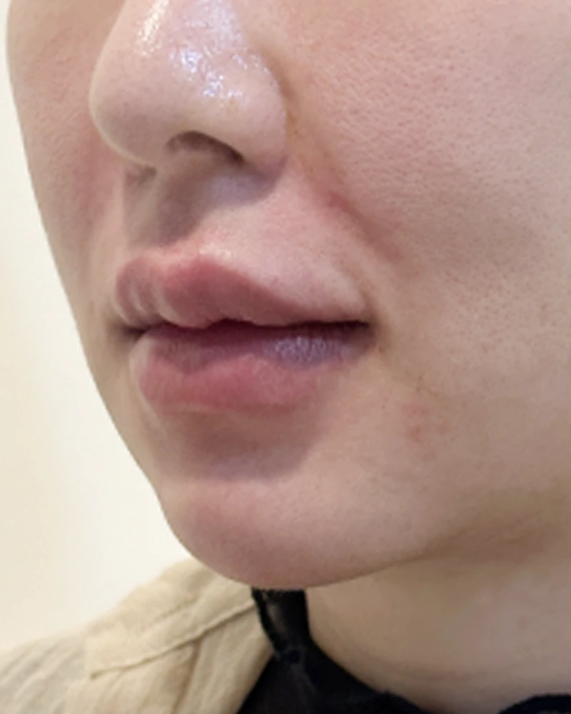 before_image