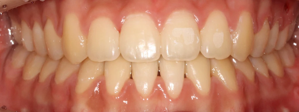 before_image