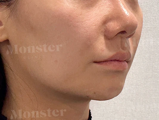 before_image